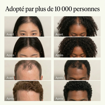 Shampoing Solide Coréen aux 12 Plantes